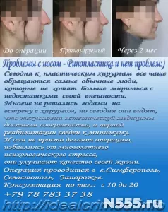 Пластическая хирургия носа, (ринопластика).